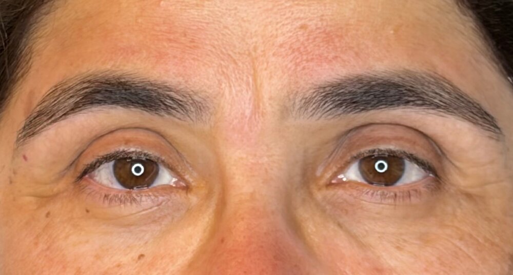 אחרי עיצוב גבות