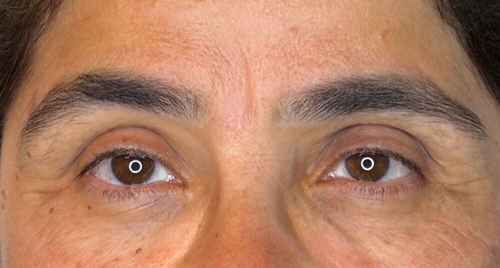 לפני עיצוב גבות